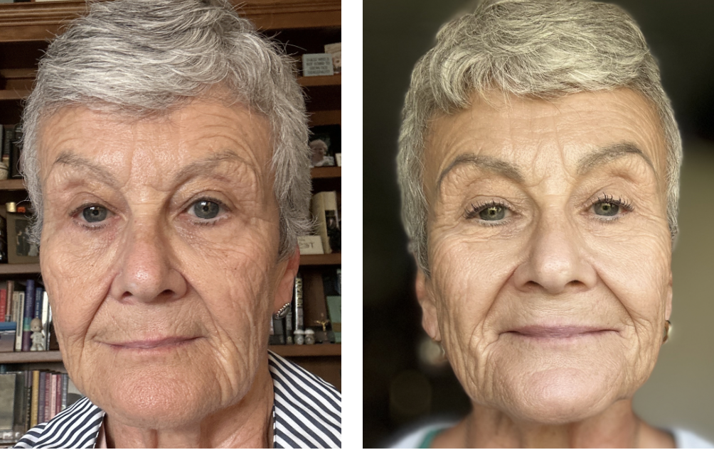 Charmaine’s Nuvane results: before on the left, after on the right